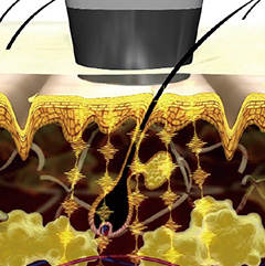 イーポレーション