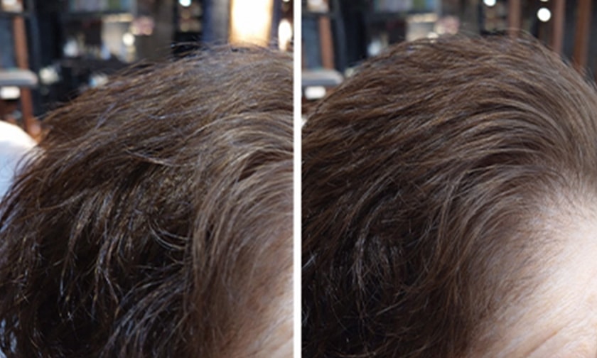 ビフォーアフター写真