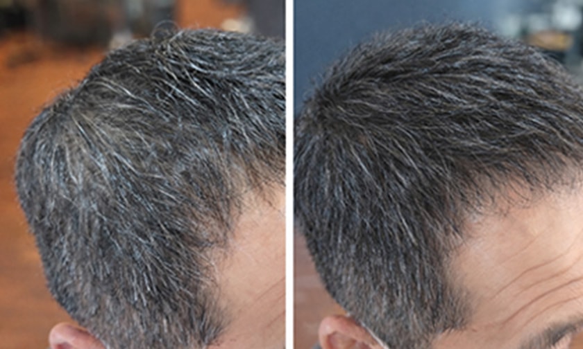 ビフォーアフター写真