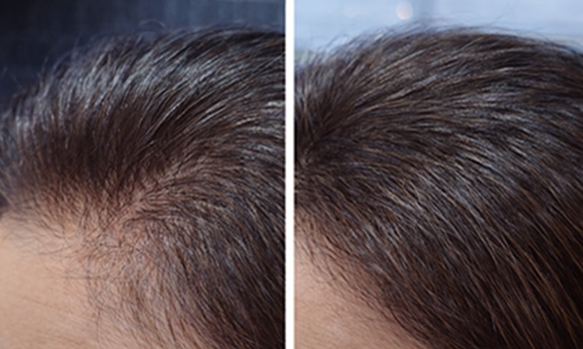 ビフォーアフター写真