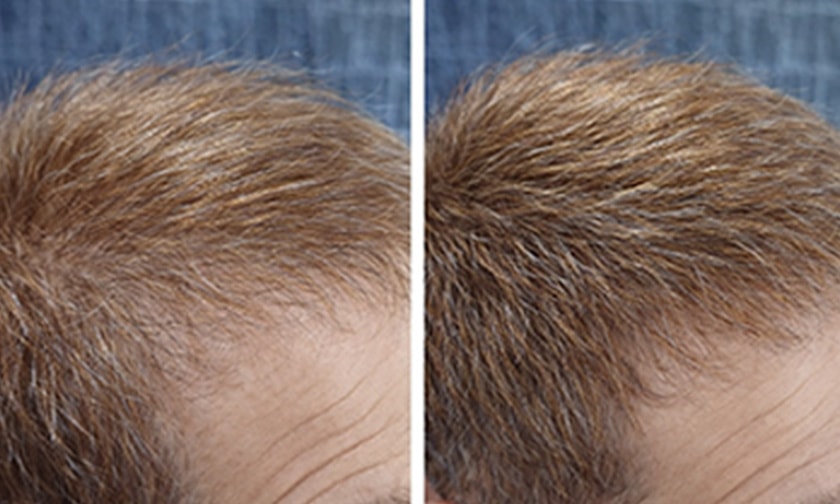 ビフォーアフター写真